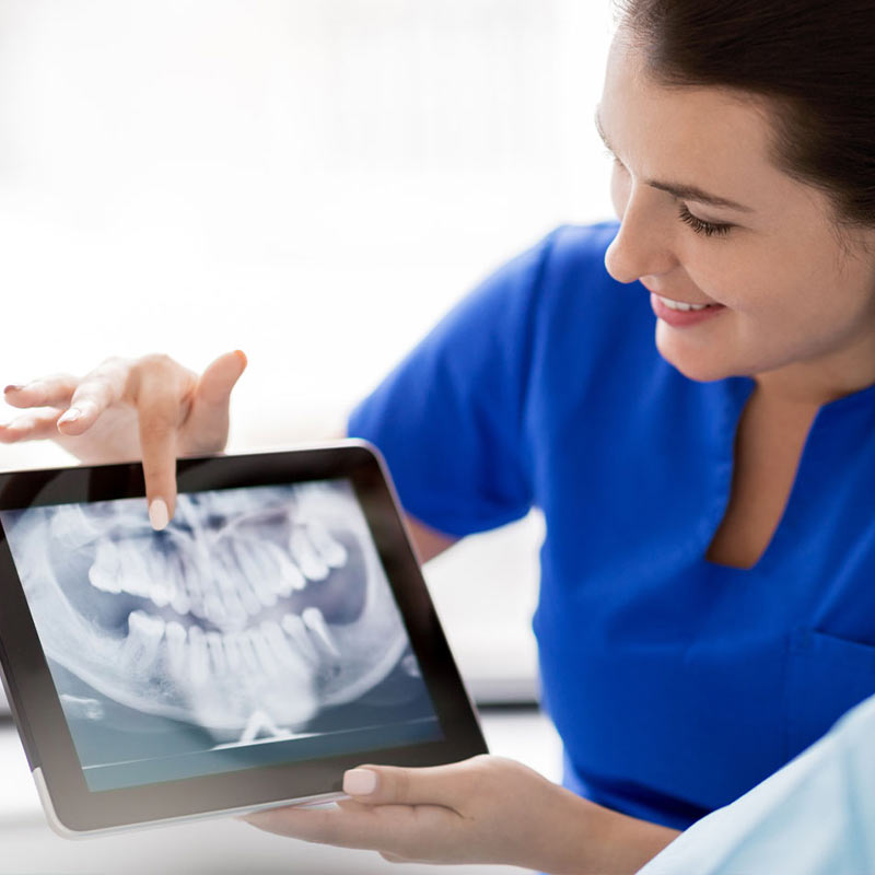 Dental Implants & Periodontics in Moline, IL