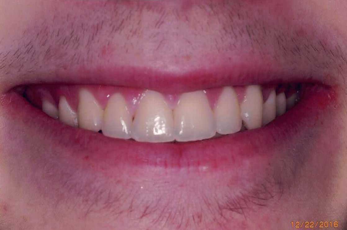 after